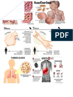 Imagenes Enfermedades Paludismo