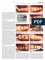 Smart Dentin Replacement: Marketplace