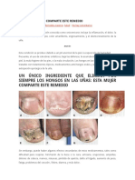 Medicina Complementaria Uñas y Peso L16mayo2016420mda