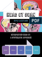 CT Scan Kepala