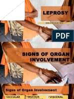Leprosy - signs or organ involvement, ethical responsibility, classification.pptx