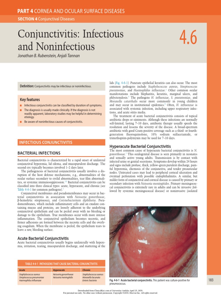 Conjunctivitis Infectious Noninfectious Infection Public Health