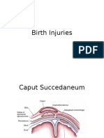 Birth Injuries