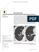 Bronkiektasis
