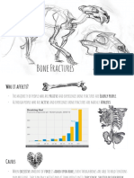 bone fractures