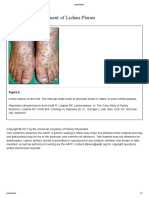 Diagnosis and Treatment of Lichen Planus: Figure 2