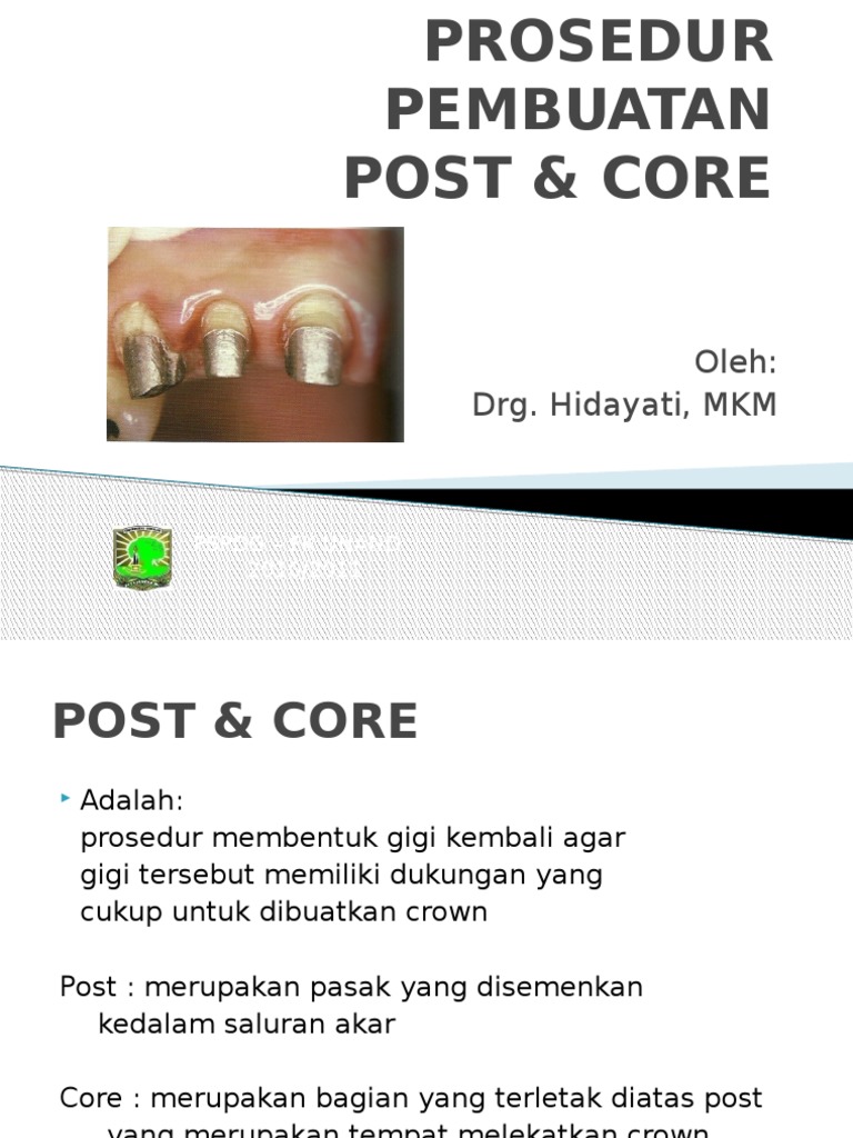 Prosedur Pembuatan Post Core | PDF