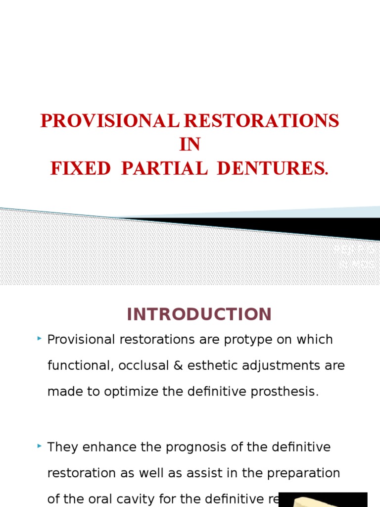 Provisional Restoration in FPD PDF Poly(Methyl Methacrylate