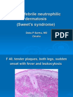 Acute Febrile Neutrophilic Dermatosis (Sweet's Syndrome) .,F 40, Leg.