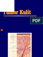 Tumor Kulit