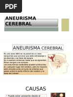 Aneurisma Cerebral