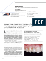 Implantes Post Extraccion1