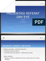 128853073-Dry-eyes