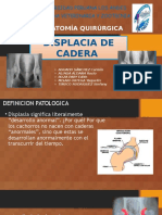 Displasia de Cadera (TEFFI-YAQUI)