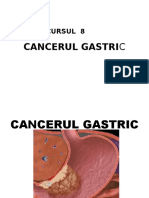 Cancerul Gastric Medicina Generala