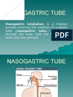 Nasogastric Tube: Nasogastric Intubation Is A Medical