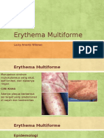 Erythema Multiforme - Lucky Ananto Wibowo