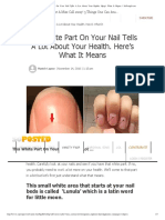 This White Part On Your Nail Tells A Lot About Your Health. Here's What It Means - SoPosted