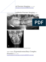 Nasal Fracture Imaging: Jesse E Smith