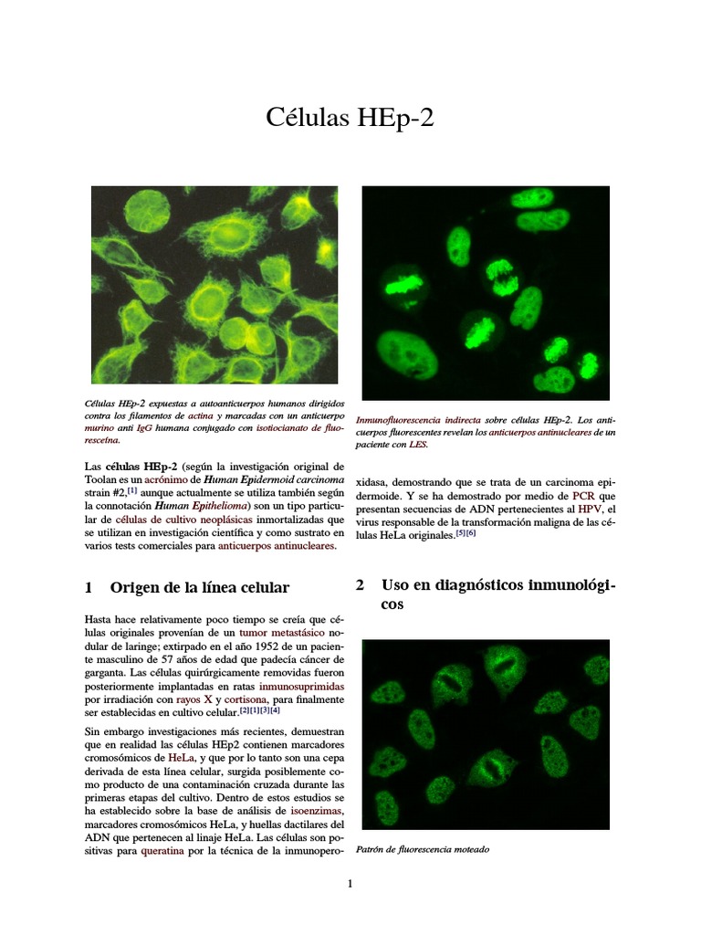 Células HEp 2 | Licencia Creative Commons | Bioquímica