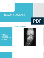 Blount Disease1