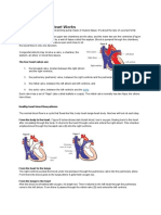 Tetrallogy of Fallot