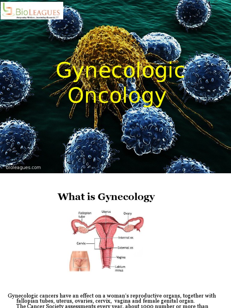 Gynecologic Oncology | PDF | Uterus | Gynaecology