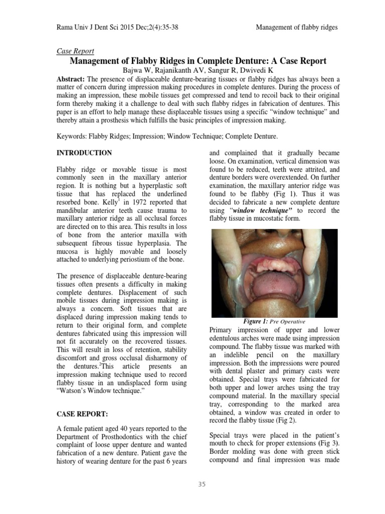 Case Report Complete Denture 2 PDF Dentures Medicine