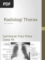 Anatomi Thorax Normal + Gambaran Radiologi | PDF