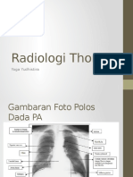 Radiologi Thorax