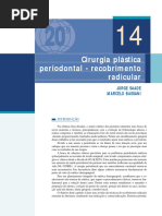 Cirurgia plástica periodontal - recobrimento  radicular