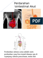 Perdarahan Gastrointestinal Akut