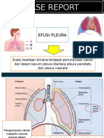 Efusi Pleura