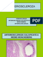 ARTERIOSCLEROZA