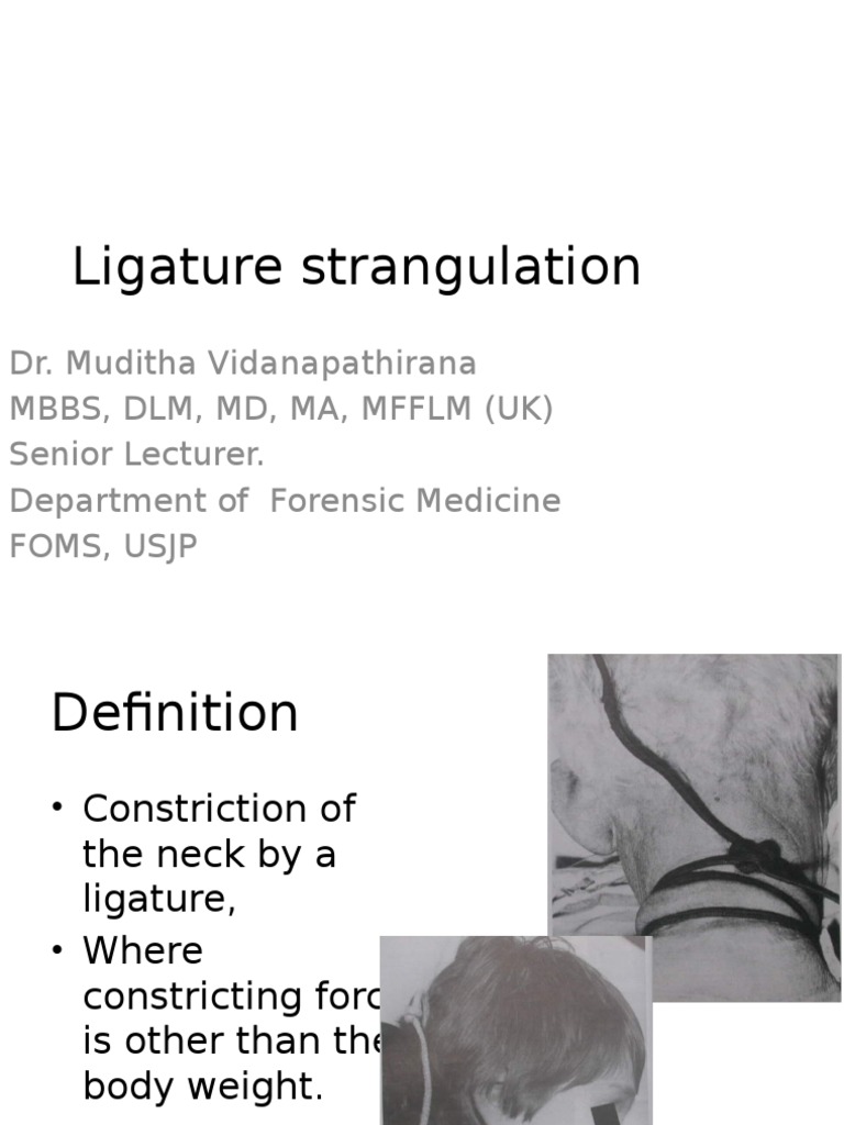 Ligature Strangulation - Students.pptx | Autopsy | Hanging | Free 30 ...