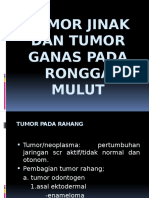 Tumor Jinak Dan Tumor Ganas Pada Rongga Mulut