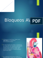 Bloqueos AV de Primer Grado: Características y Electrocardiograma