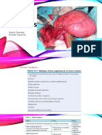 TUMORES CARDIACOS