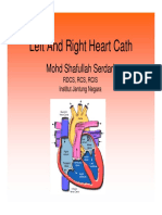 Left and Right Heart Cath Procedure Overview