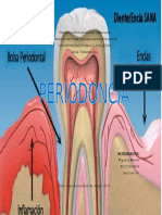 Trabajo Periodoncia