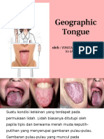 Geographic Tongue Lidah Geografis