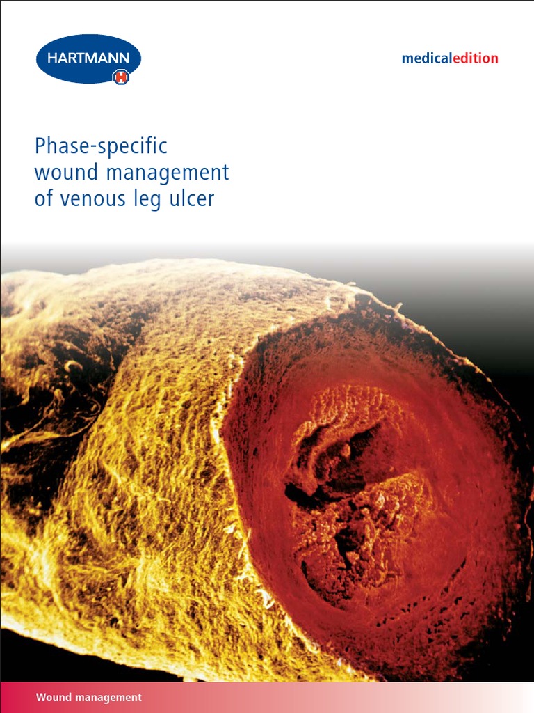 Wound Management of Venous Leg Ulcer, Hartmann, 2006 | PDF | Vein ...
