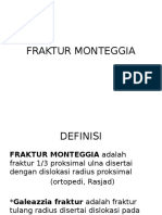 Fraktur Monteggia