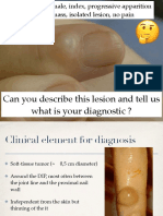 3 - Clinical Cases Mucous Cyst