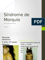 Síndrome de Morquio (MPS)