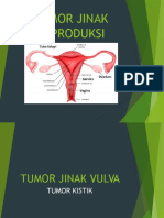 Tumor Jinak Reproduksi