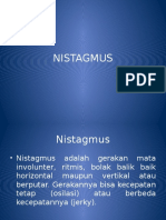 Nistagmus