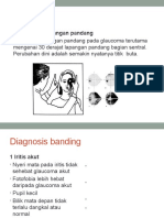 OD Glaukoma Akut Dan OS Glaukoma Absolut 5