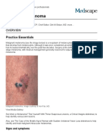 Malignant Melanoma_ Practice Essentials, Background, Etiology