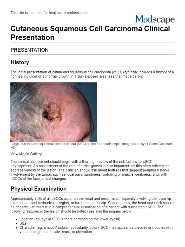 Cutaneous Squamous Cell Carcinoma Clinical Presentation